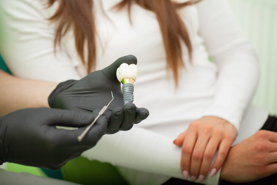 how much are dental implants